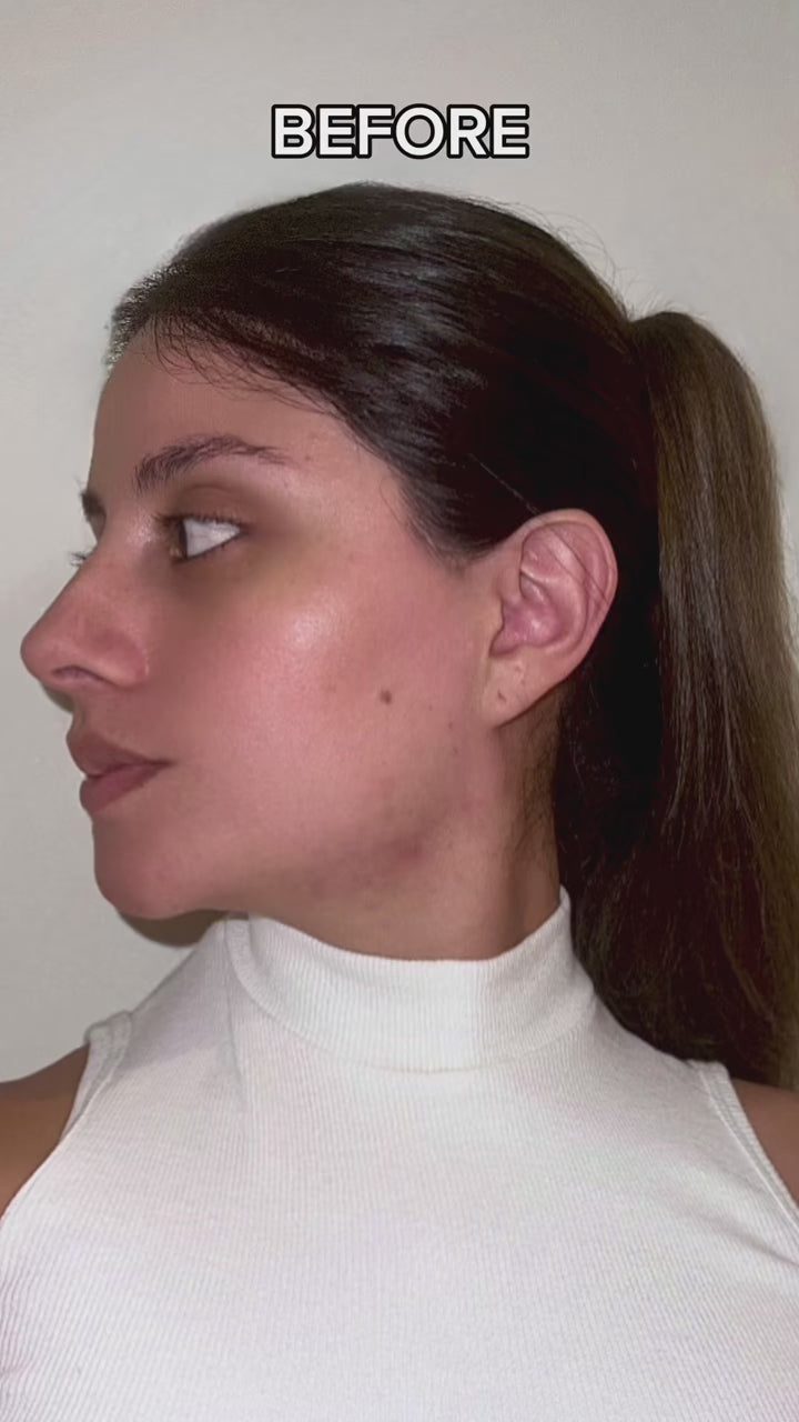 قناع الوجه Heartizon™ GlowLift بتقنية LED